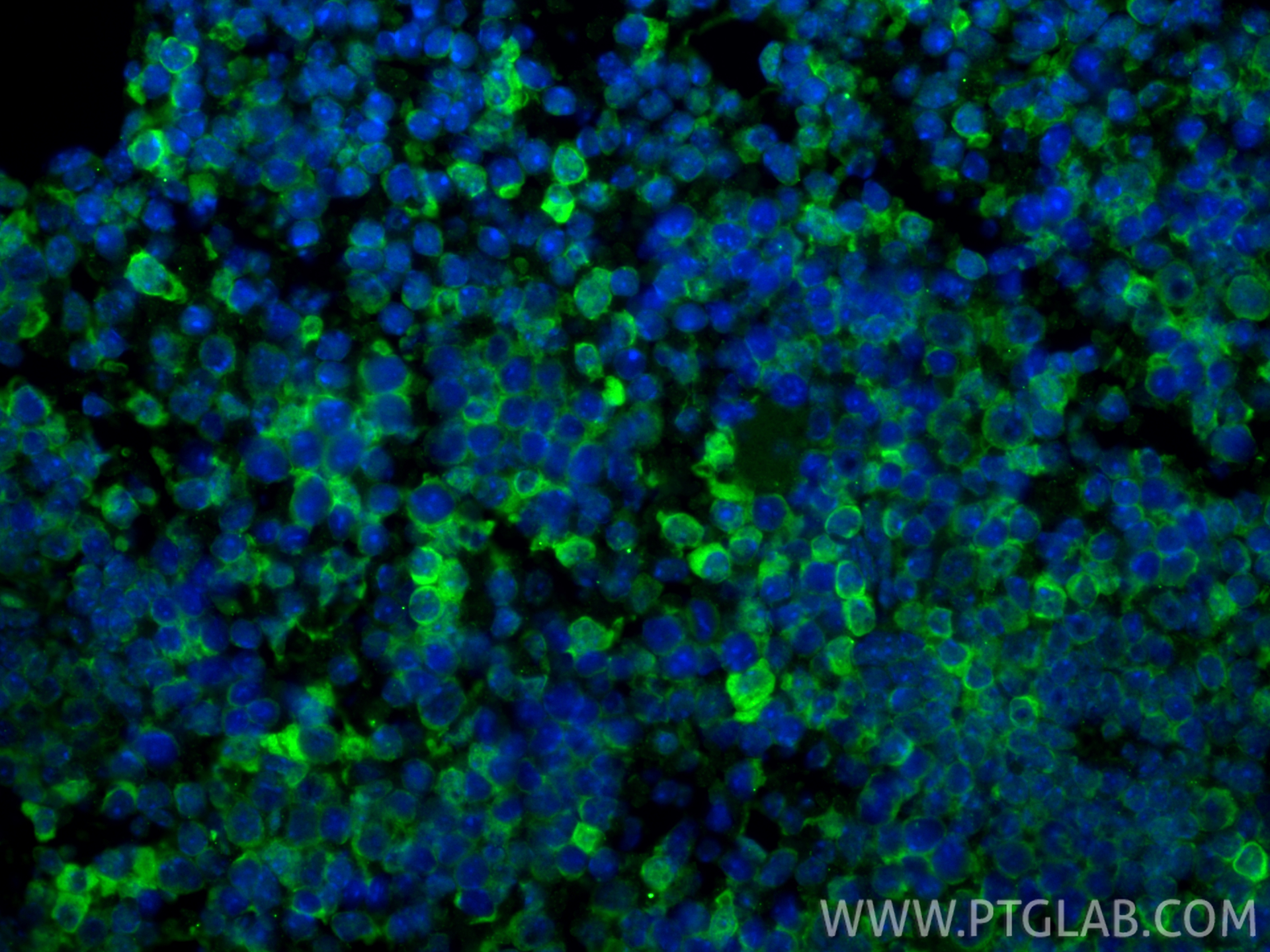 Immunofluorescence (IF) / fluorescent staining of mouse spleen tissue using PD-1/CD279 Monoclonal antibody (66220-1-Ig)