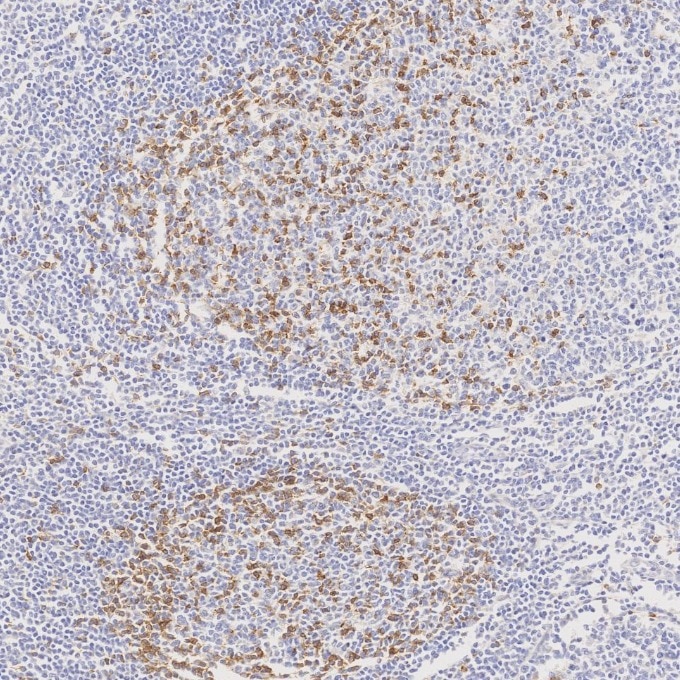 Immunohistochemistry (IHC) staining of human tonsillitis tissue using PD-1/CD279 Monoclonal antibody (66220-1-Ig)
