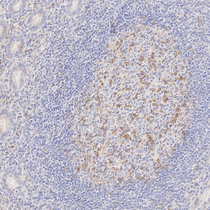 Immunohistochemistry (IHC) staining of human appendicitis tissue using PD-1/CD279 Monoclonal antibody (66220-1-Ig)