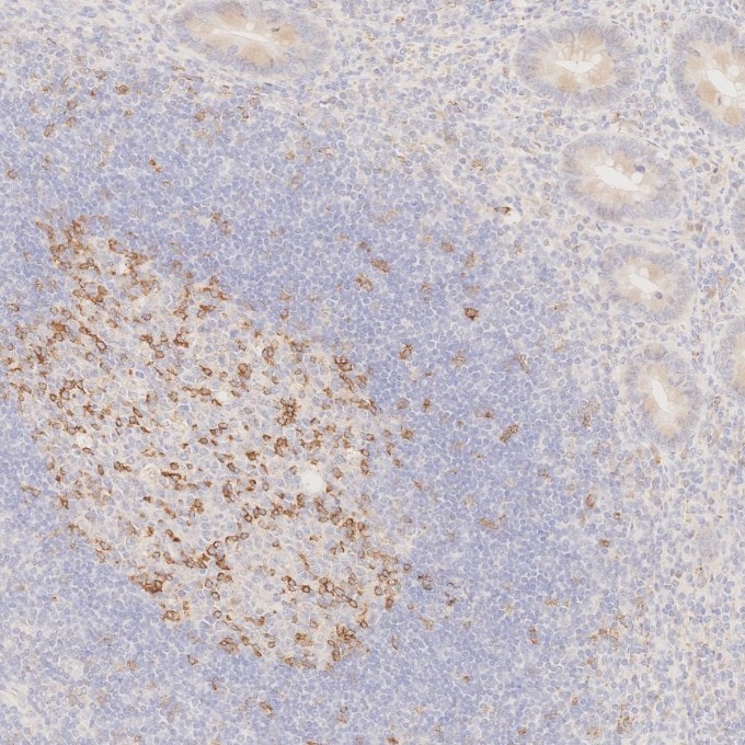 Immunohistochemistry (IHC) staining of human appendicitis tissue using PD-1/CD279 Monoclonal antibody (66220-1-Ig)
