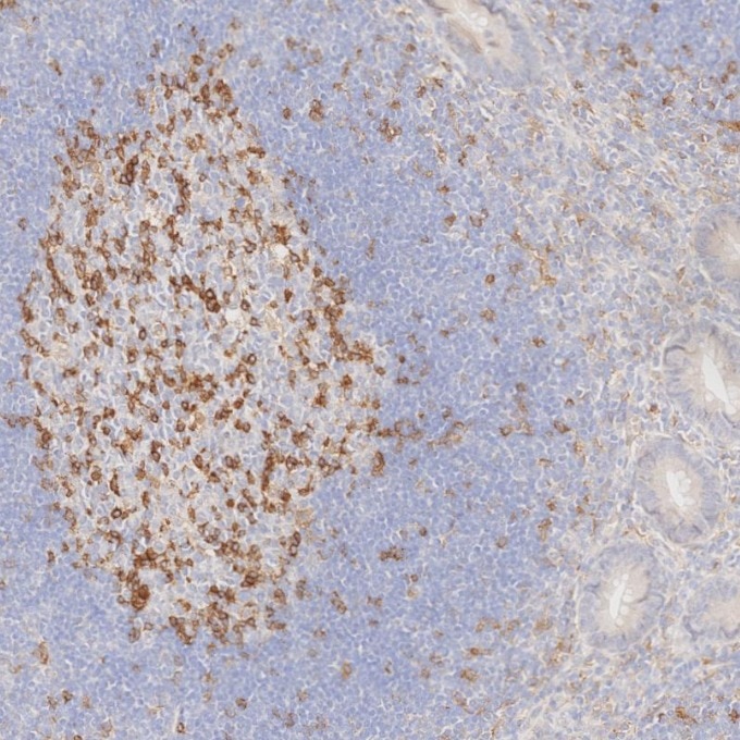 Immunohistochemistry (IHC) staining of human appendicitis tissue using PD-1/CD279 Monoclonal antibody (66220-1-Ig)