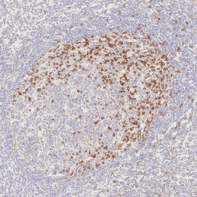 Immunohistochemistry (IHC) staining of human tonsillitis tissue using PD-1/CD279 Monoclonal antibody (66220-1-Ig)