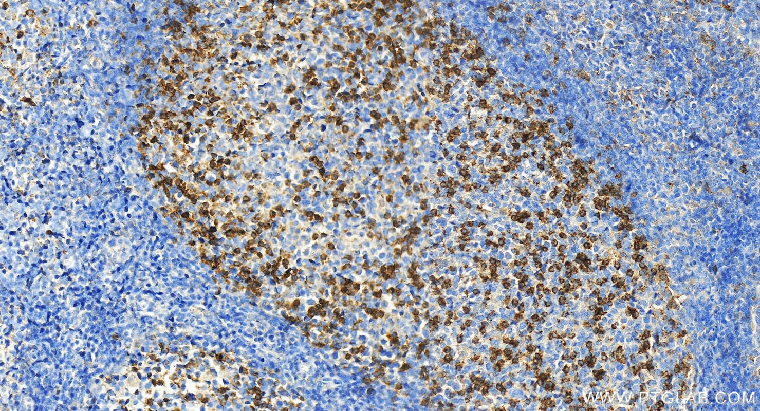 Immunohistochemistry (IHC) staining of human tonsillitis tissue using PD-1/CD279 Monoclonal antibody (66220-1-Ig)