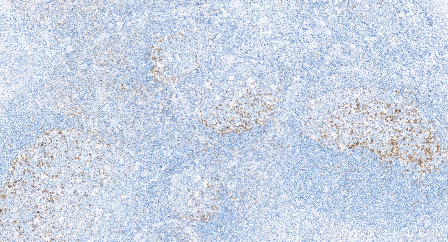 Immunohistochemistry (IHC) staining of human tonsillitis tissue using Anti-Human PD-1/CD279 Rabbit Recombinant Antibody (98068-1-RR)