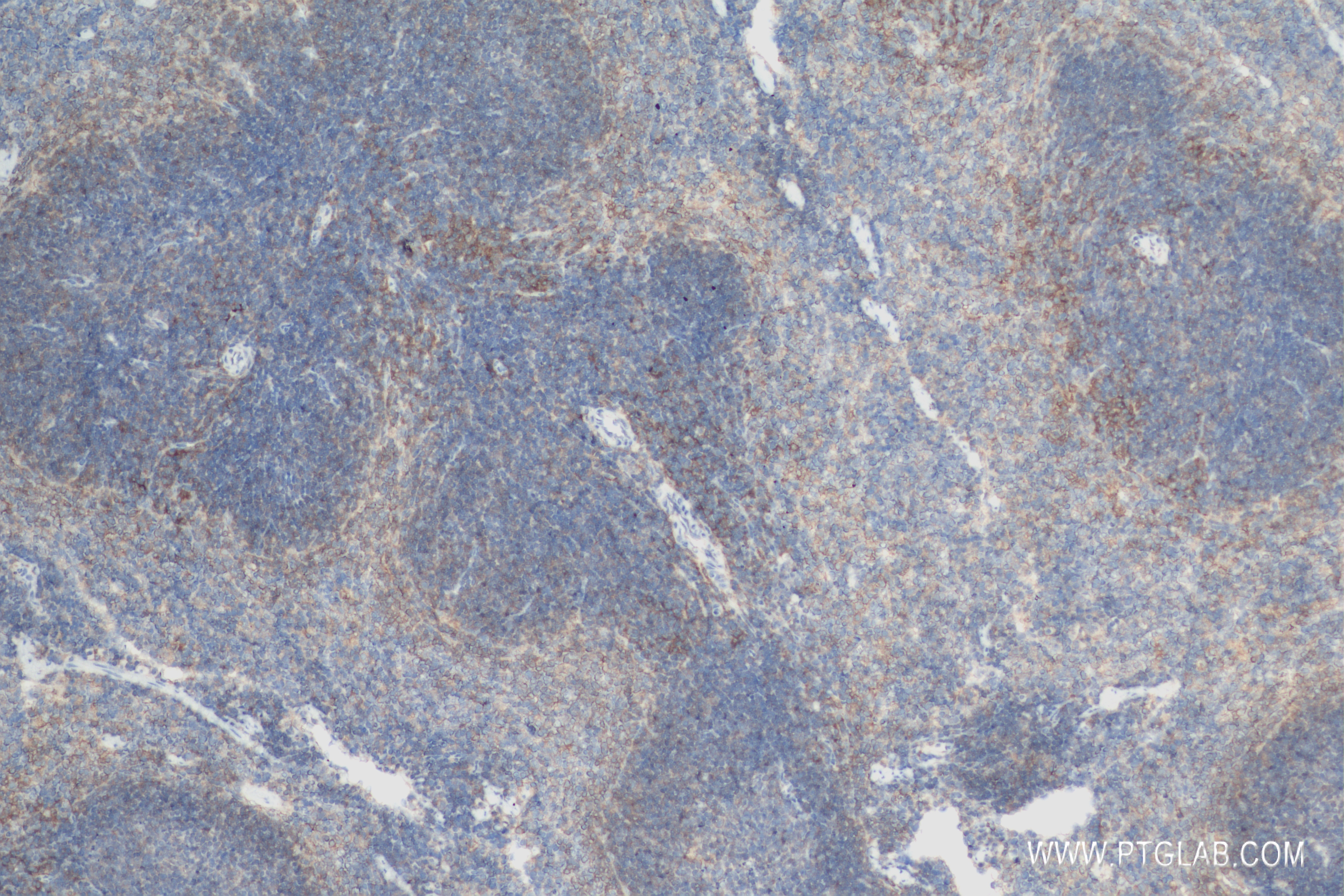 Immunohistochemistry (IHC) staining of mouse spleen tissue using PD-L1/CD274 Recombinant antibody (83906-6-RR)