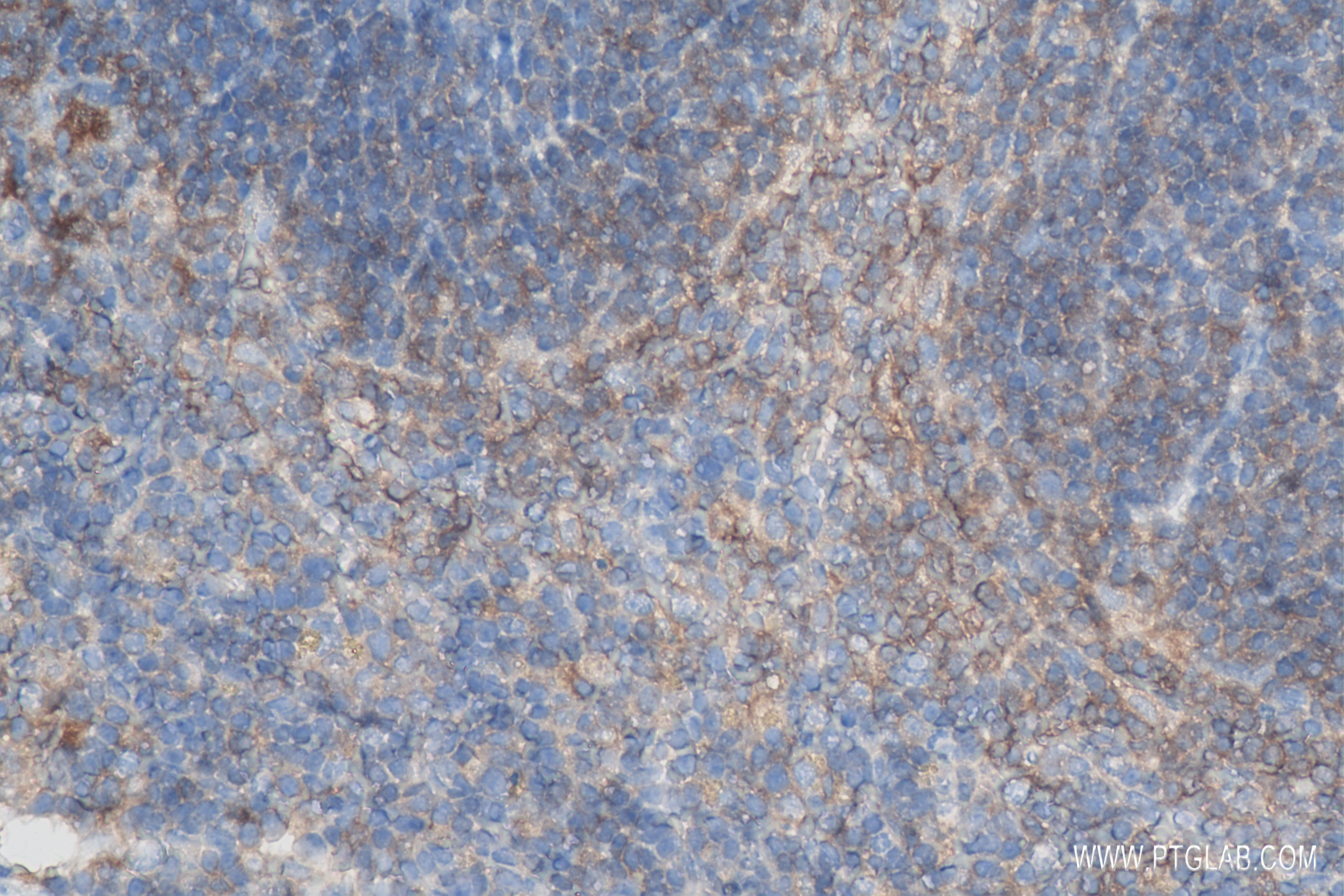 Immunohistochemistry (IHC) staining of mouse spleen tissue using PD-L1/B7-H1 Recombinant antibody (83906-6-RR)