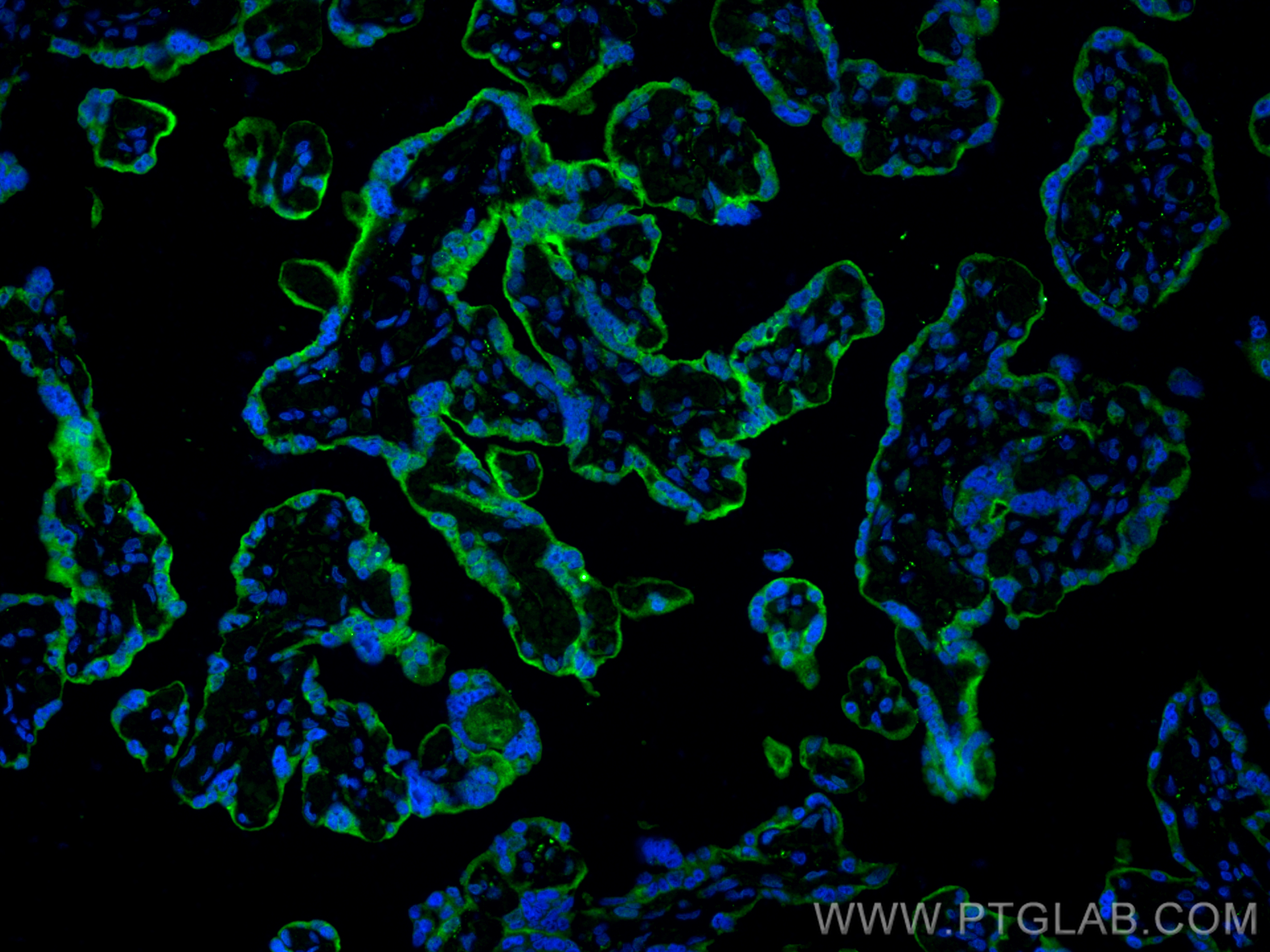 Immunofluorescence (IF) / fluorescent staining of human placenta tissue using PD-L1/CD274 (C-terminal) Polyclonal antibody (28076-1-AP)