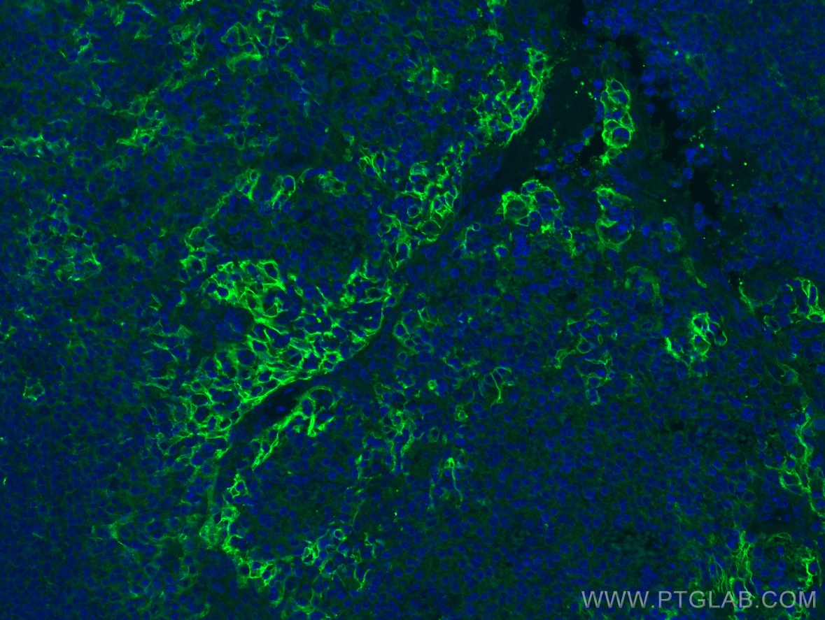 Immunofluorescence (IF) / fluorescent staining of human tonsillitis tissue using PD-L1/CD274 (C-terminal) Polyclonal antibody (28076-1-AP)