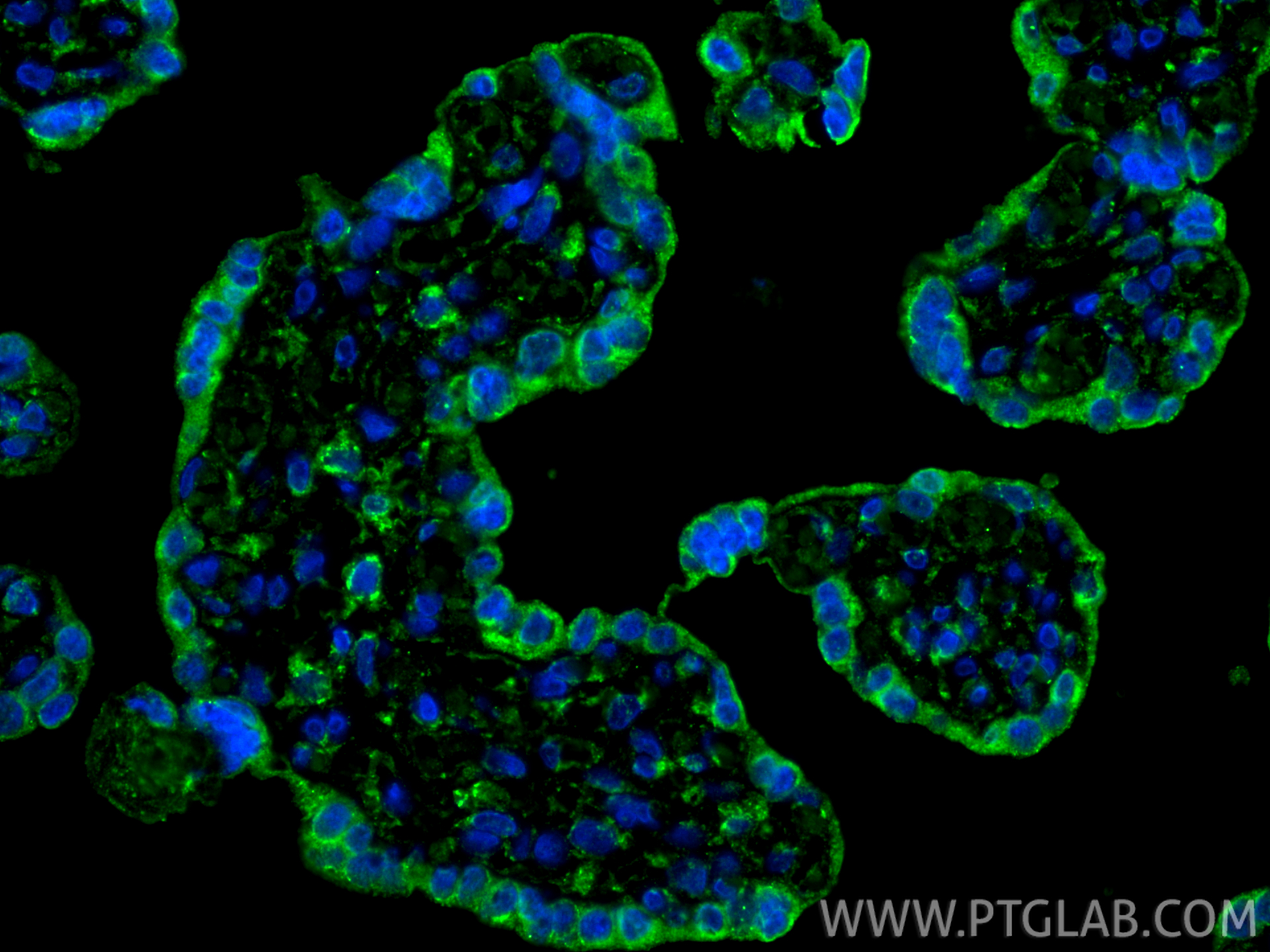 Immunofluorescence (IF) / fluorescent staining of human placenta tissue using PD-L1/CD274 Monoclonal antibody (66248-1-Ig)