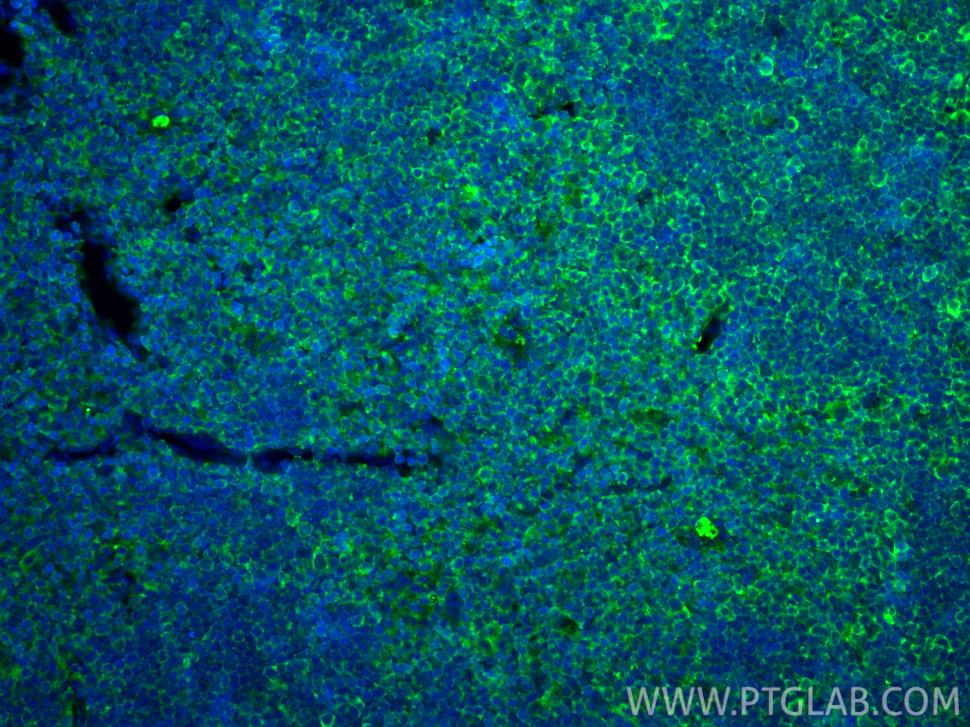 Immunofluorescence (IF) / fluorescent staining of mouse thymus tissue using PD-L1/CD274 Monoclonal antibody (66248-1-Ig)