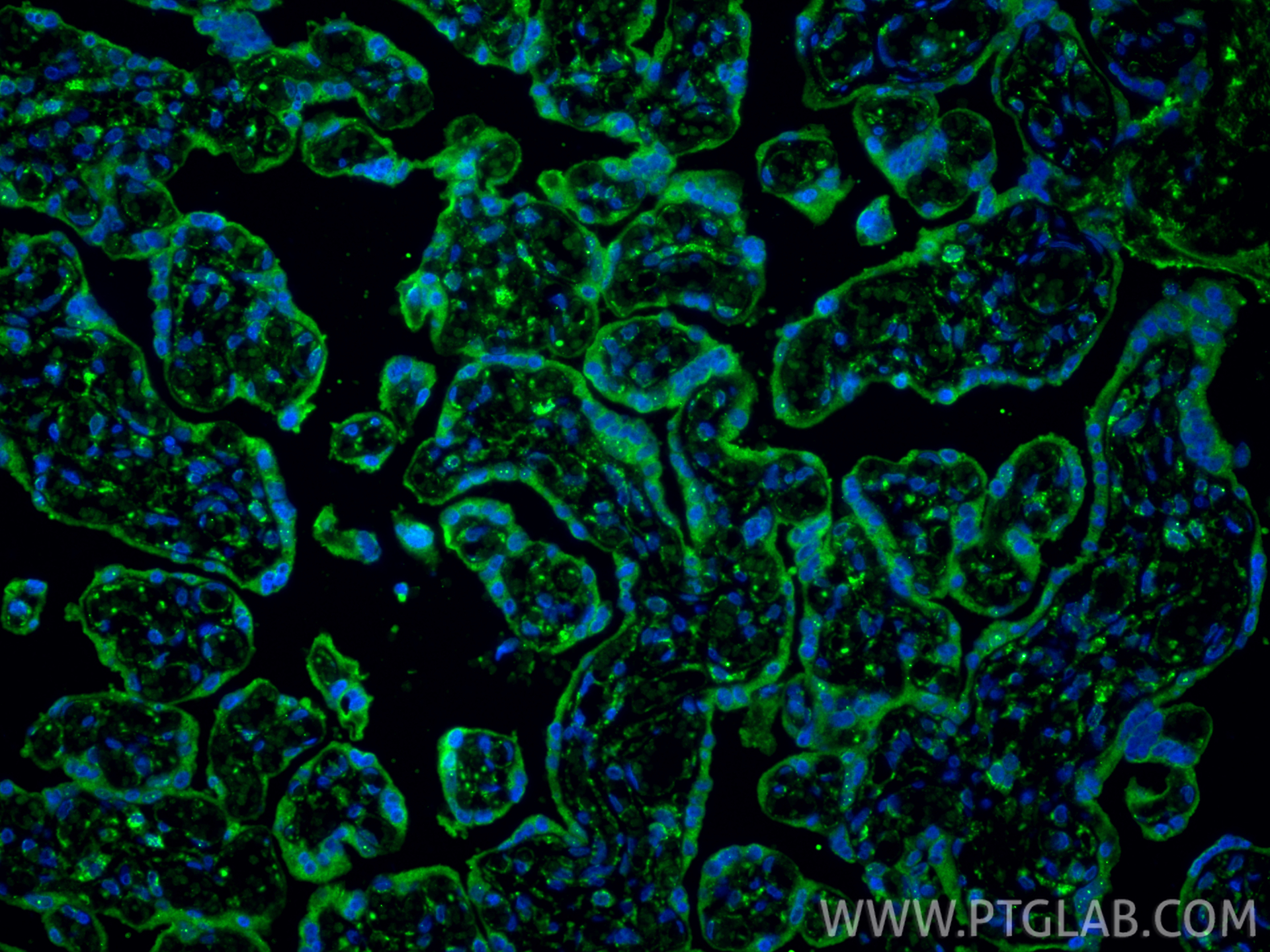 Immunofluorescence (IF) / fluorescent staining of human placenta tissue using PD-L1/CD274 Monoclonal antibody (66248-1-Ig)