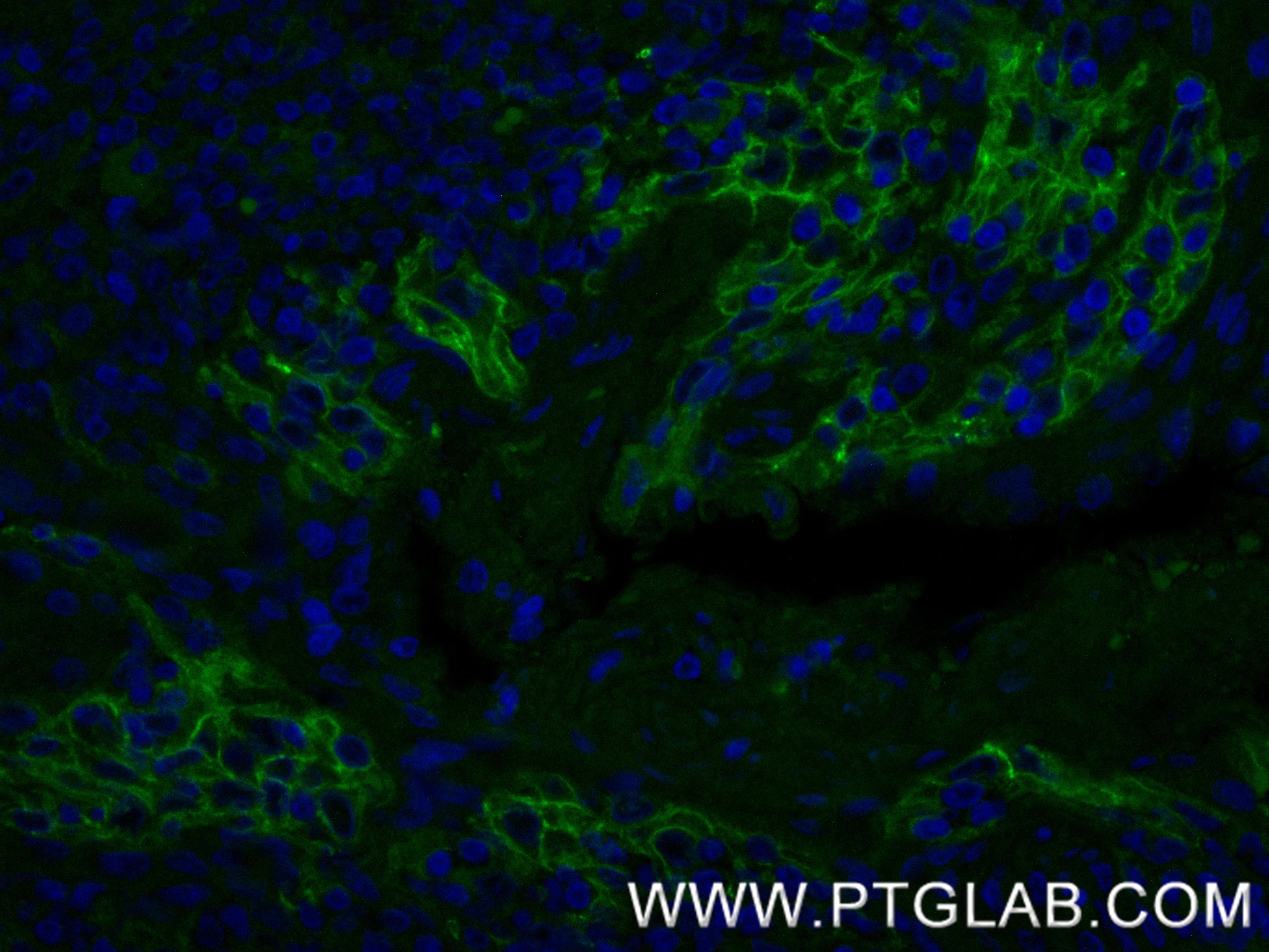 Immunofluorescence (IF) / fluorescent staining of human tonsillitis tissue using PD-L1/CD274 Recombinant monoclonal antibody (82719-13-RR)