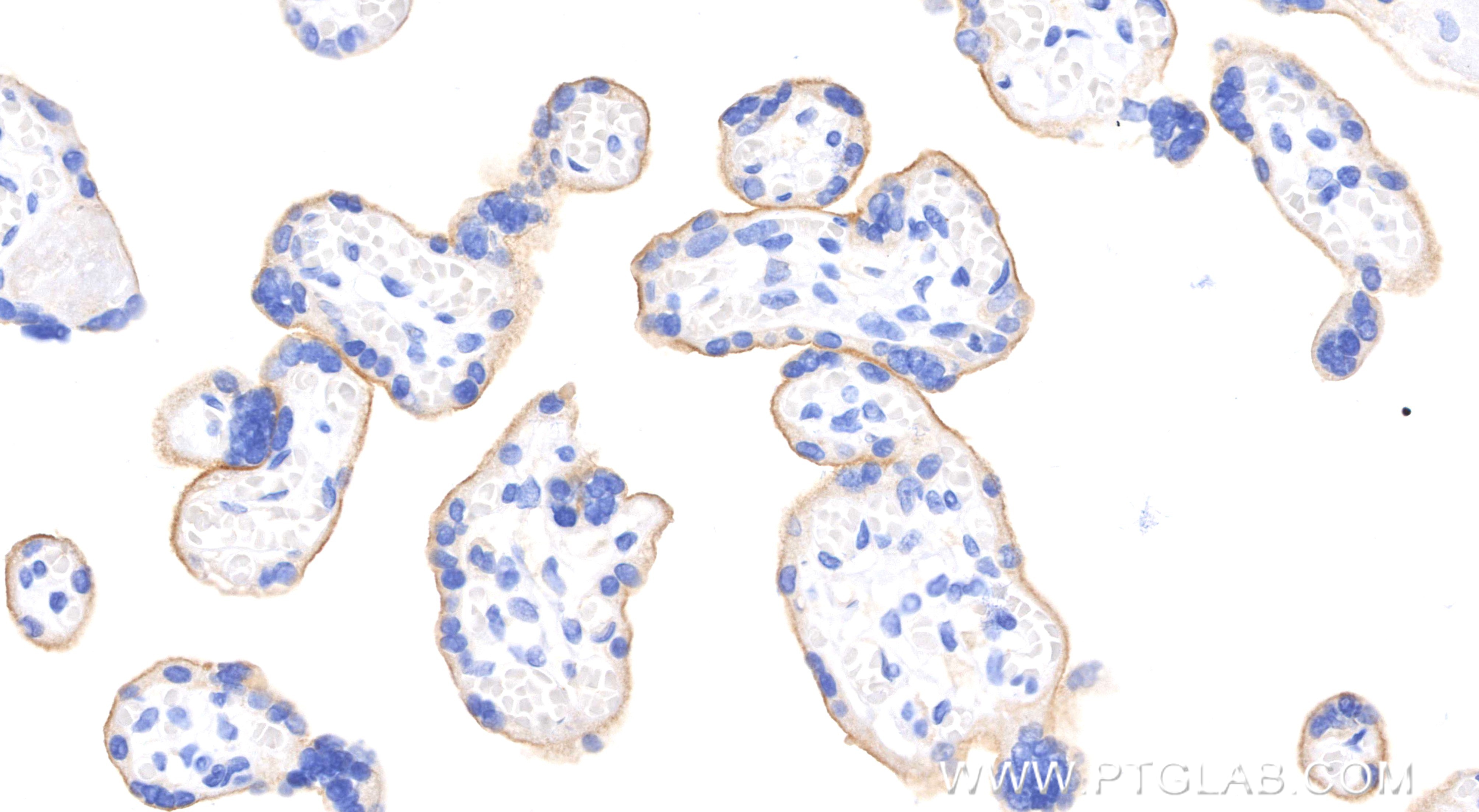 Immunohistochemistry (IHC) staining of human placenta tissue using PD-L1/CD274 Recombinant monoclonal antibody (82719-13-RR)
