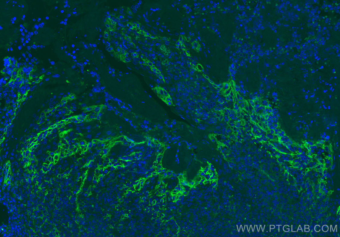 Immunofluorescence (IF) / fluorescent staining of human tonsillitis tissue using PD-L1/CD274 Recombinant antibody (82719-15-RR)