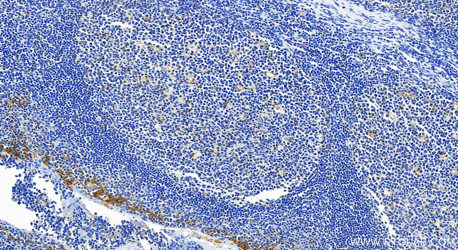 Immunohistochemistry (IHC) staining of human tonsillitis tissue using PD-L1/CD274 Recombinant antibody (82719-15-RR)