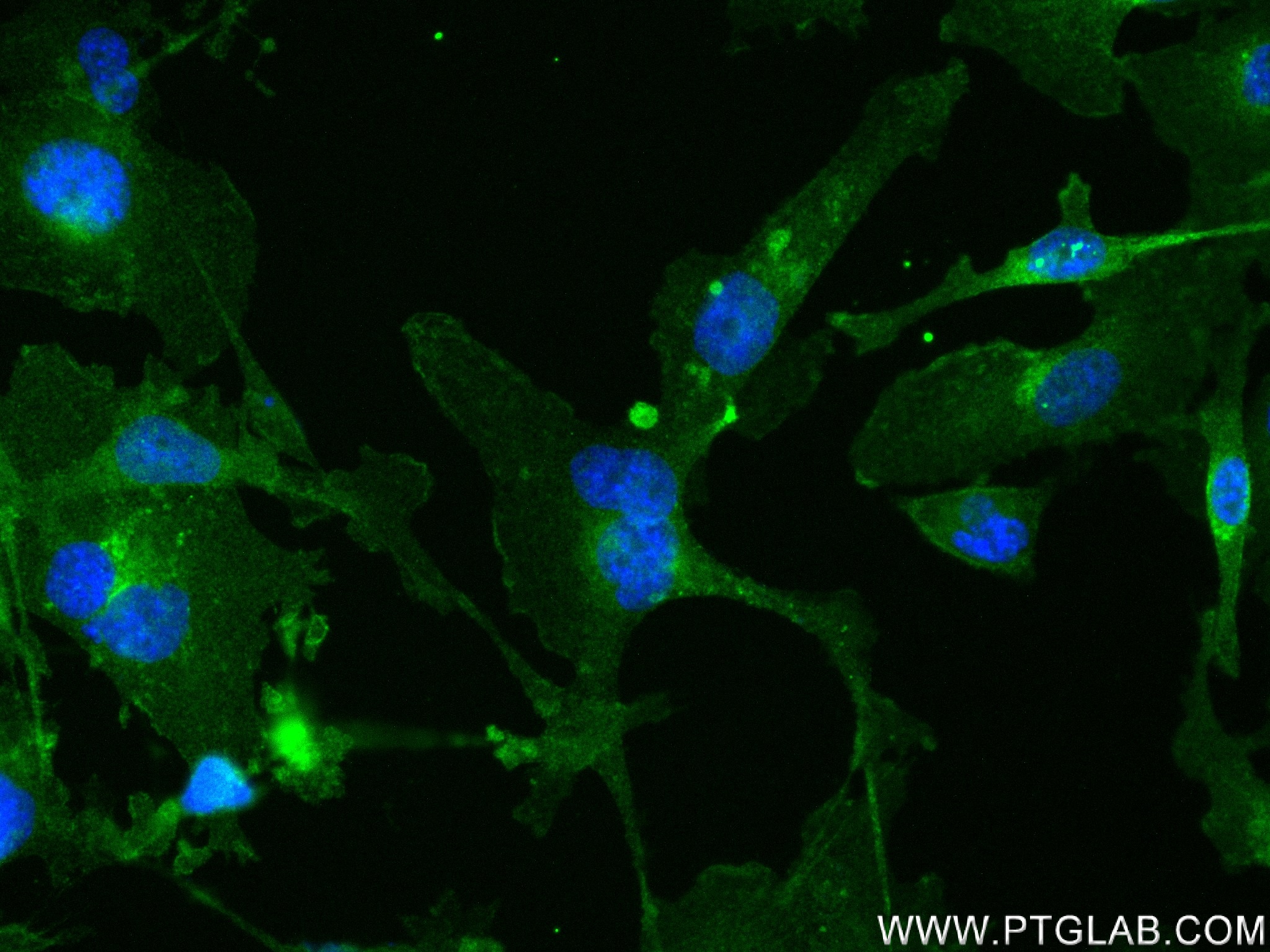 Immunofluorescence (IF) / fluorescent staining of MDA-MB-231 cells using PD-L1/CD274 Recombinant antibody (83600-2-RR)