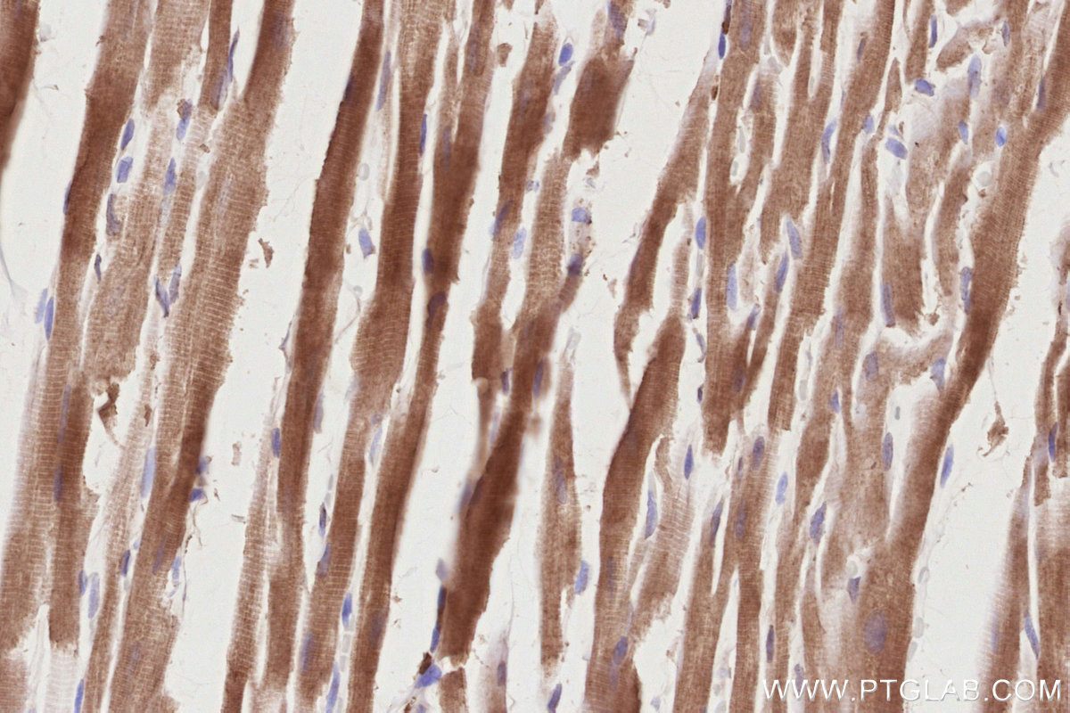 Immunohistochemistry (IHC) staining of rat heart tissue using PD-L2/CD273 Polyclonal antibody (27406-1-AP)