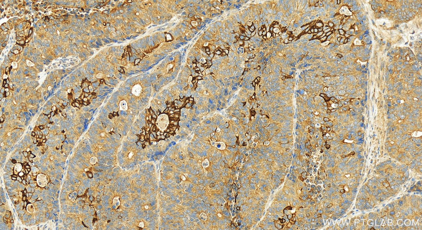 Immunohistochemistry (IHC) staining of human stomach tissue using PDCD6 Polyclonal antibody (12303-1-AP)