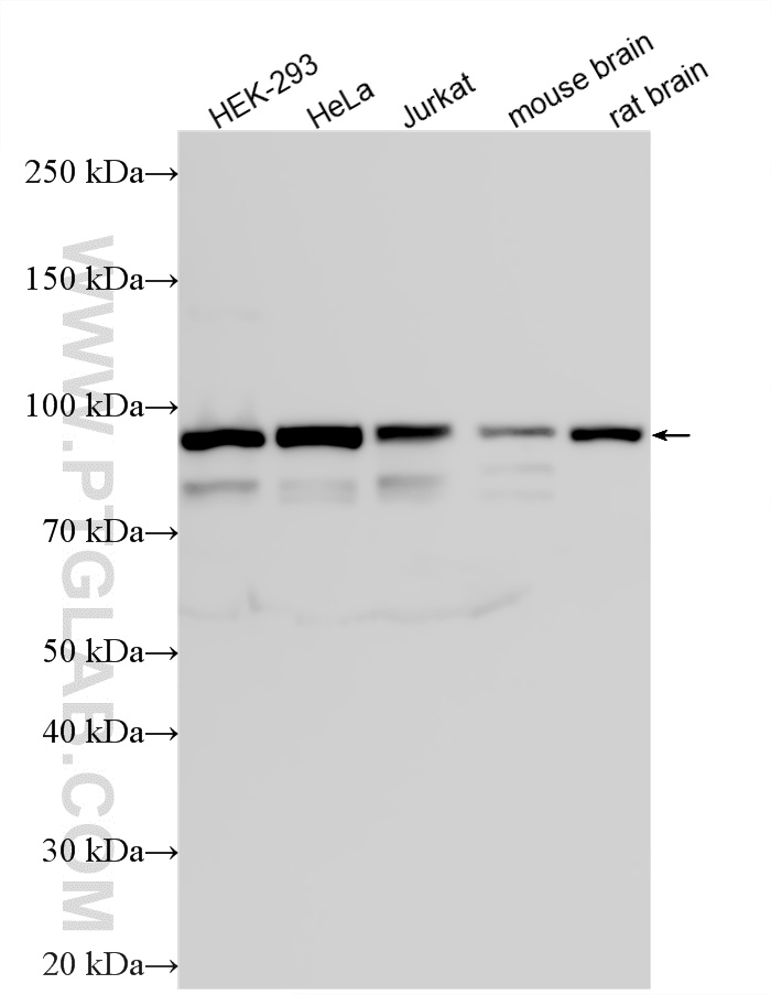 Western Blot (WB) analysis of various lysates using Alix Polyclonal antibody (12422-1-AP)
