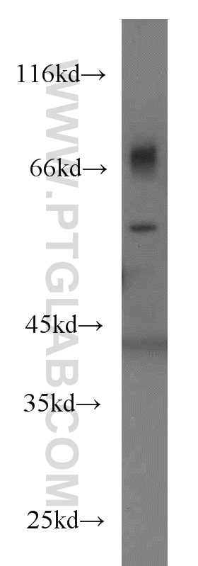 Western Blot (WB) analysis of Jurkat cells using PDCD7 Polyclonal antibody (12485-1-AP)