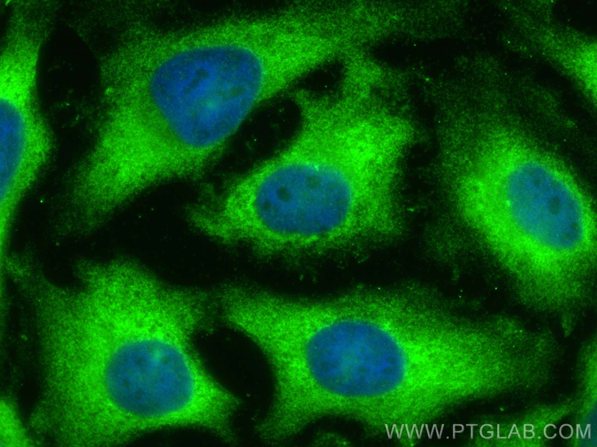 Immunofluorescence (IF) / fluorescent staining of HeLa cells using PDE4D Polyclonal antibody (12918-1-AP)