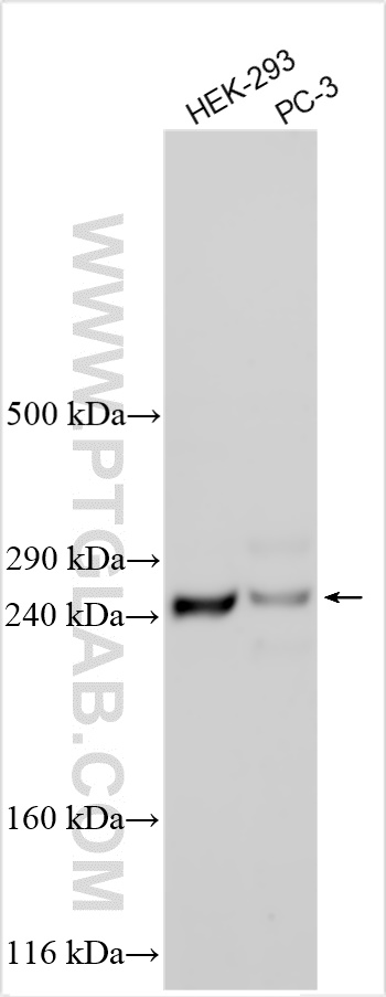 Western Blot (WB) analysis of various lysates using PDE4DIP Polyclonal antibody (12637-1-AP)