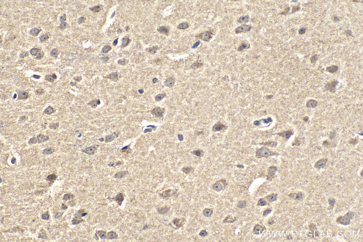 Immunohistochemistry (IHC) staining of mouse brain tissue using PDE6D Monoclonal antibody (67565-1-Ig)