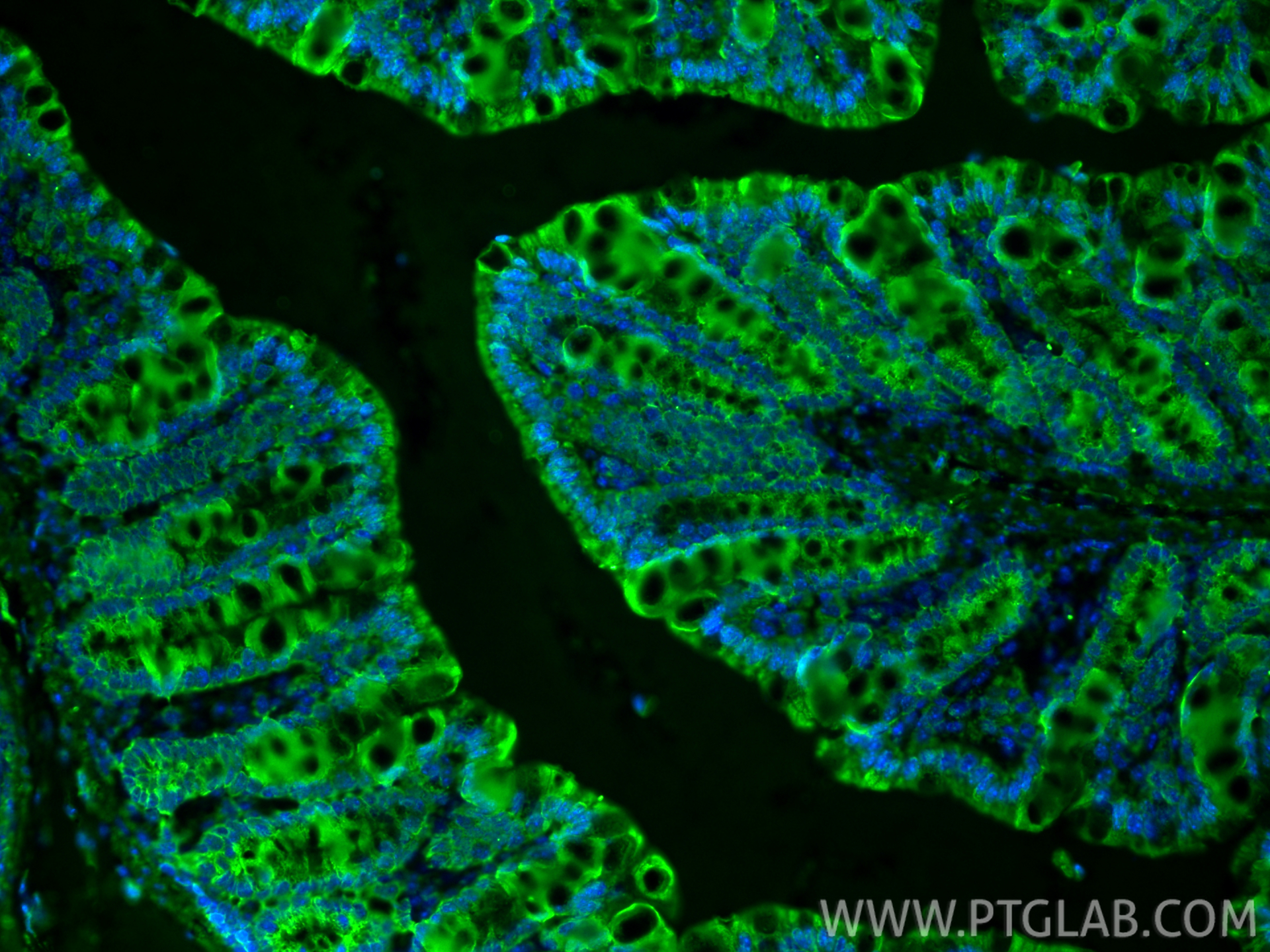 Immunofluorescence (IF) / fluorescent staining of mouse colon tissue using PDGFR beta/CD140b Polyclonal antibody (13449-1-AP)