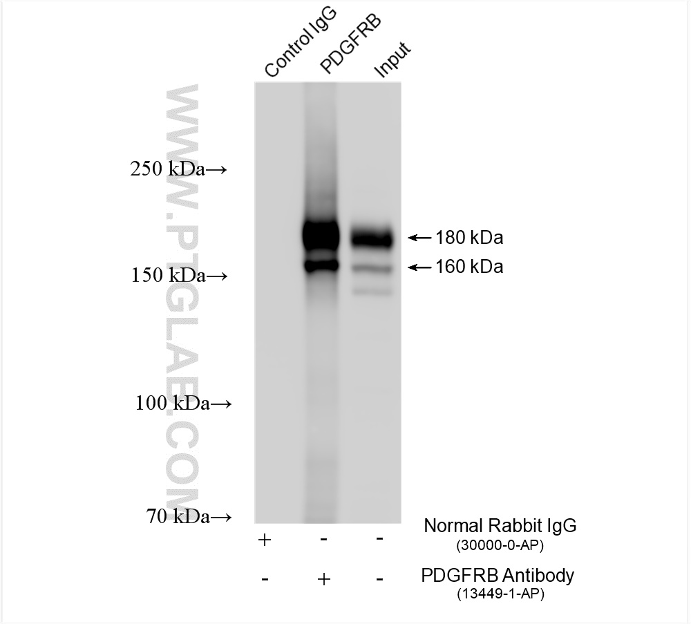 Immunoprecipitation (IP) experiment of mouse lung tissue using PDGFR beta/CD140b Polyclonal antibody (13449-1-AP)