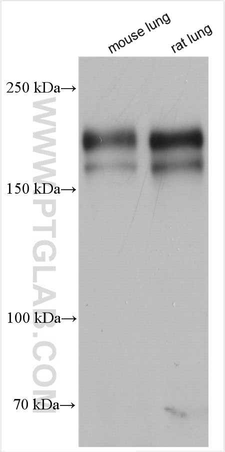 Western Blot (WB) analysis of various lysates using PDGFR beta Polyclonal antibody (13449-1-AP)