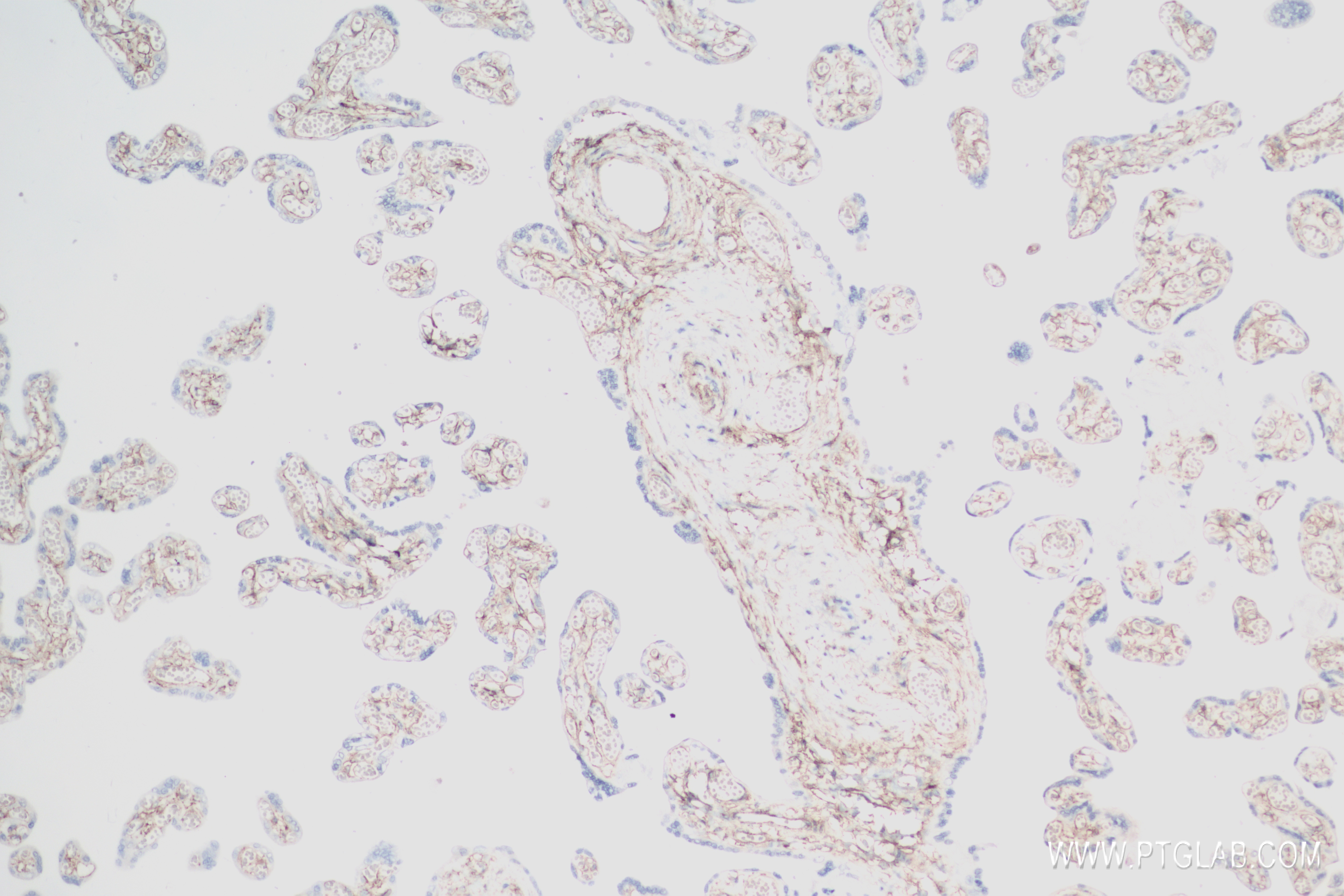 Immunohistochemistry (IHC) staining of human placenta tissue using PDGFR beta/CD140b Recombinant antibody (82943-1-RR)