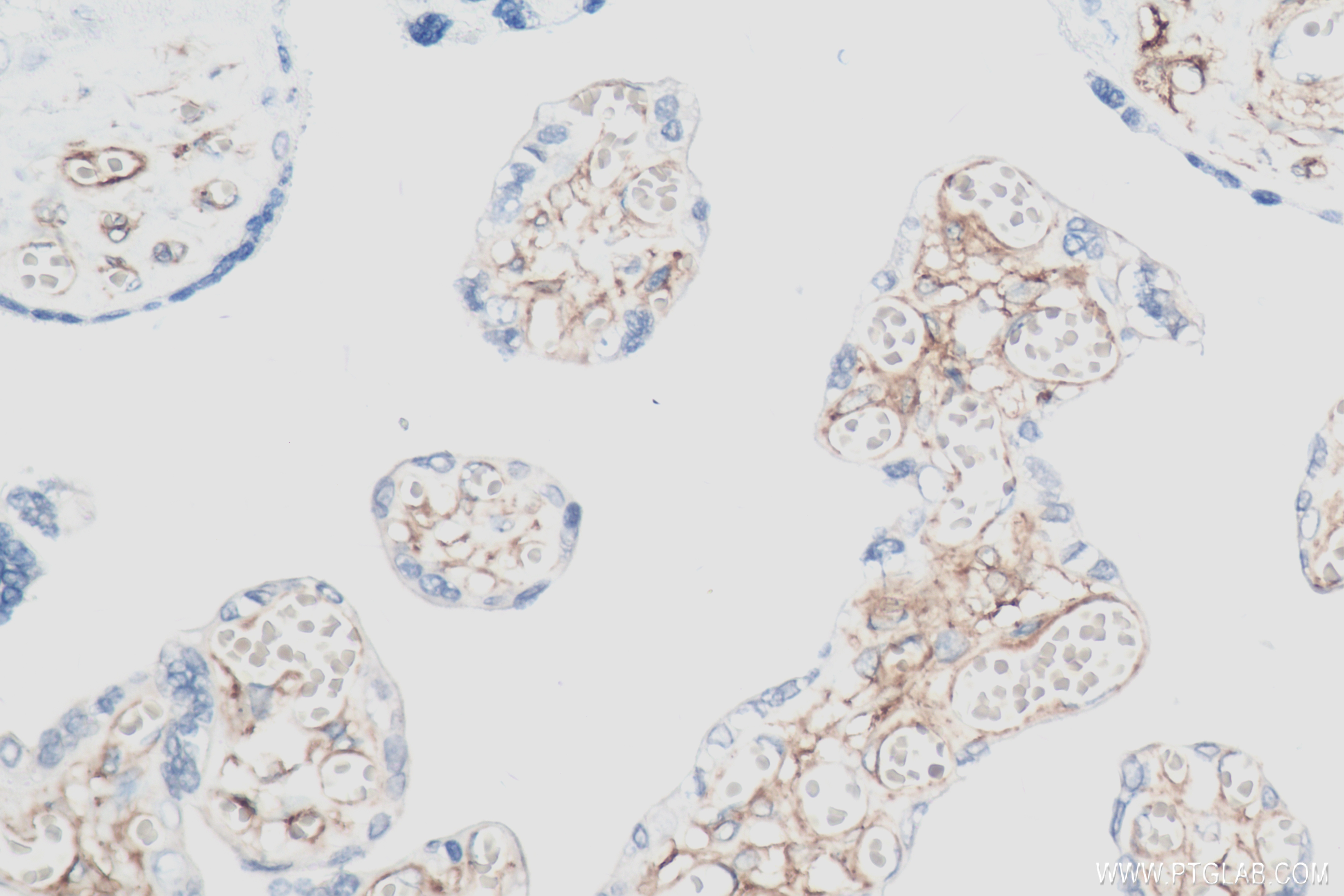 Immunohistochemistry (IHC) staining of human placenta tissue using PDGFR beta/CD140b Recombinant antibody (82943-1-RR)