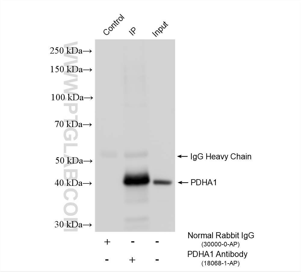 Immunoprecipitation (IP) experiment of HeLa cells using PDH E1 Alpha Polyclonal antibody (18068-1-AP)