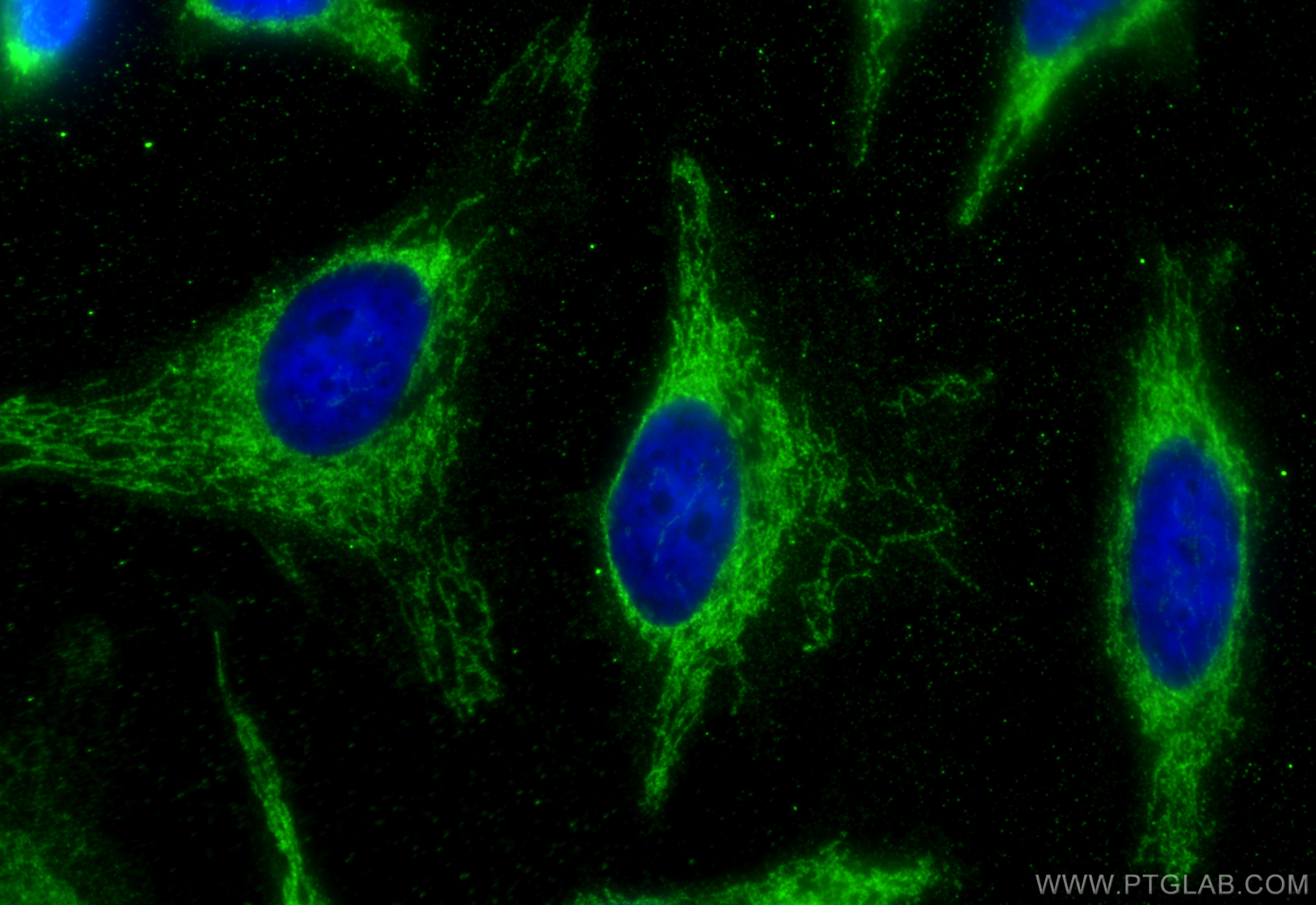 Immunofluorescence (IF) / fluorescent staining of HeLa cells using PDH E1 Alpha Monoclonal antibody (66119-1-Ig)