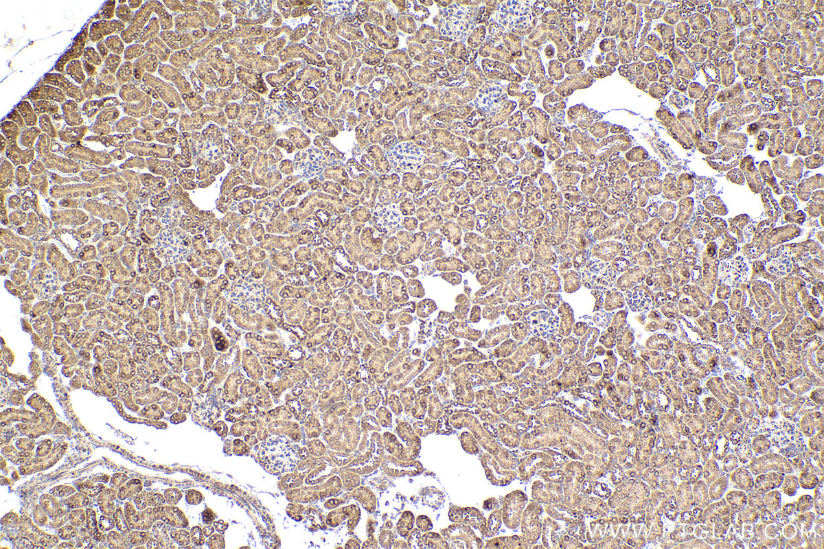 Immunohistochemistry (IHC) staining of mouse kidney tissue using PDHB Monoclonal antibody (68238-1-Ig)