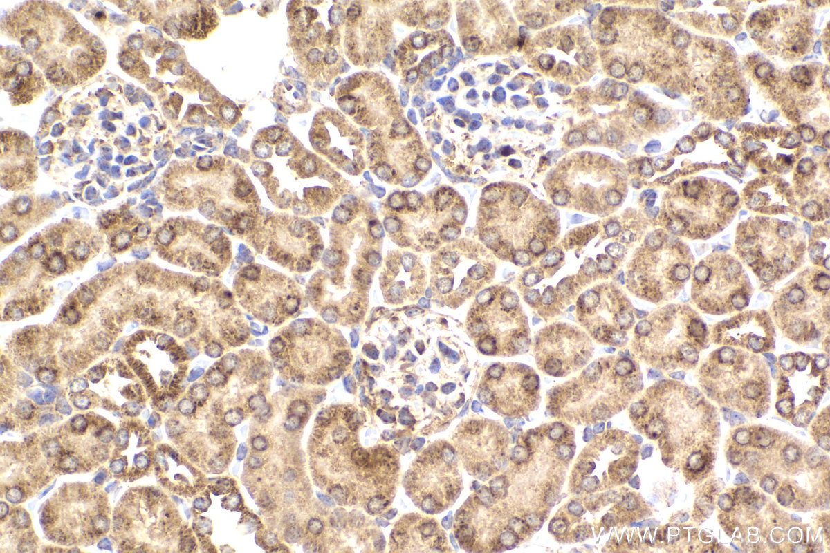 Immunohistochemistry (IHC) staining of mouse kidney tissue using PDHB Monoclonal antibody (68238-1-Ig)