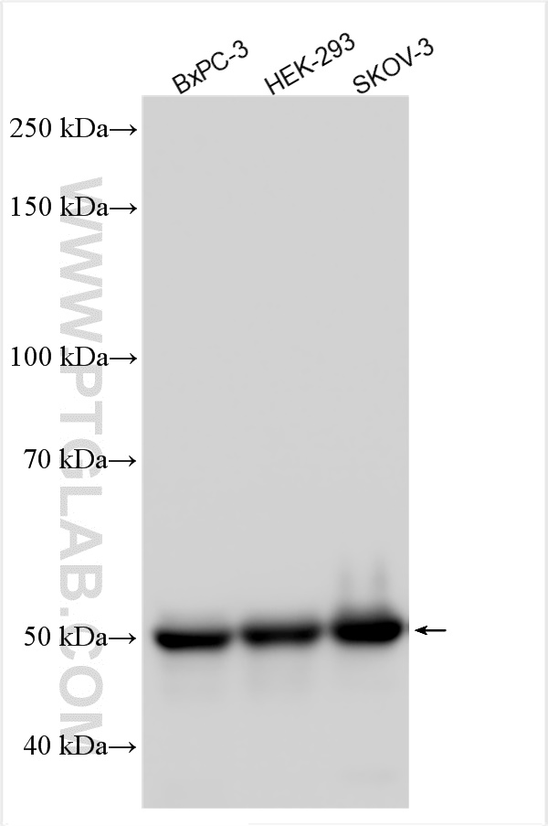 Western Blot (WB) analysis of various lysates using PDHX Polyclonal antibody (10951-1-AP)