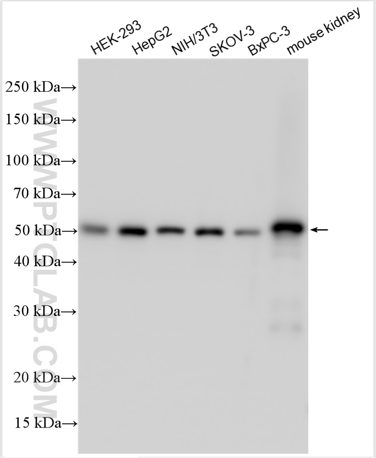 Western Blot (WB) analysis of various lysates using PDHX Polyclonal antibody (10951-1-AP)