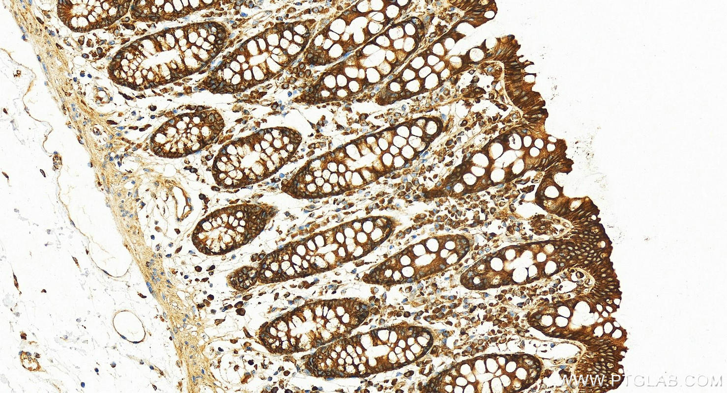 Immunohistochemistry (IHC) staining of human colon tissue using PDI Recombinant antibody (80170-1-RR)