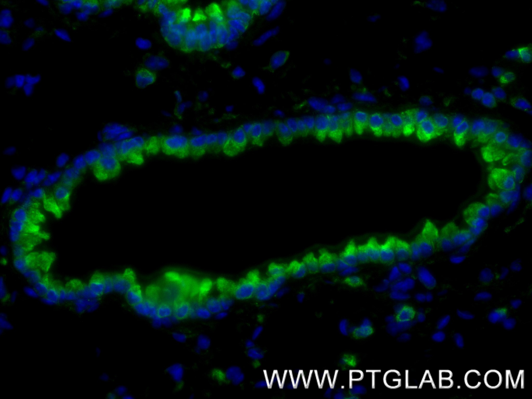 Immunofluorescence (IF) / fluorescent staining of mouse lung tissue using PDI Recombinant antibody (80170-1-RR)