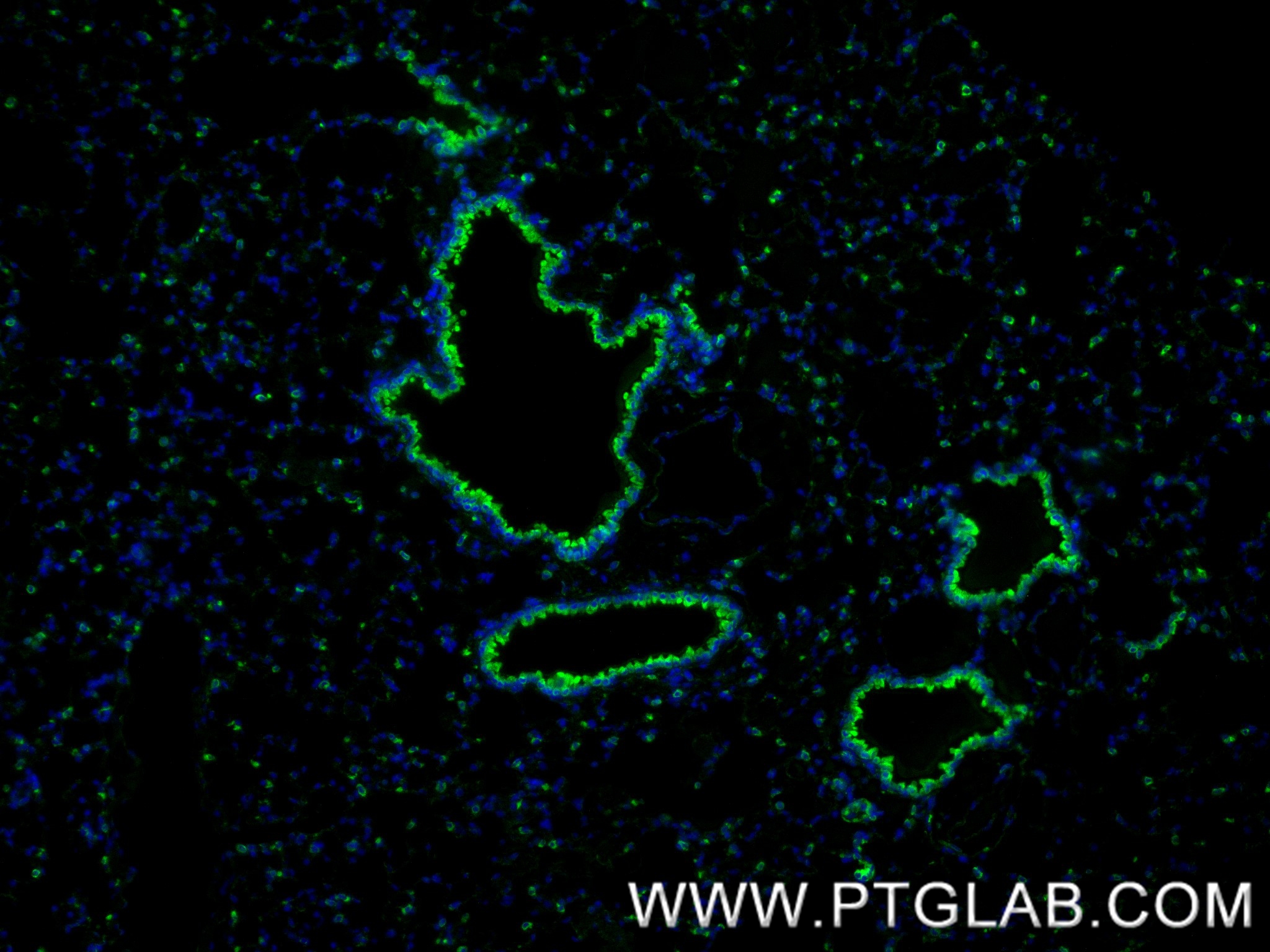 Immunofluorescence (IF) / fluorescent staining of mouse lung tissue using PDI Recombinant antibody (80170-1-RR)