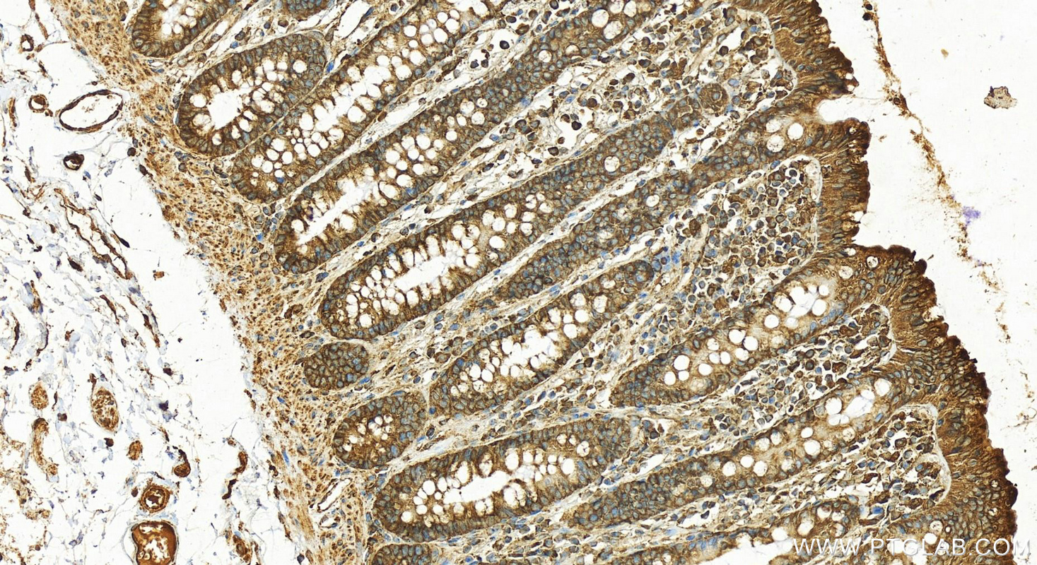 Immunohistochemistry (IHC) staining of human colon tissue using PDI Polyclonal antibody (11245-1-AP)