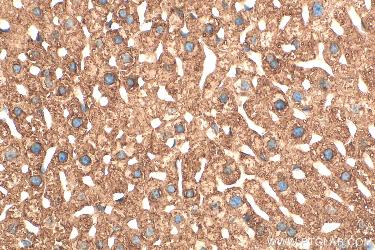 Immunohistochemistry (IHC) staining of mouse liver tissue using PDI Polyclonal antibody (11245-1-AP)