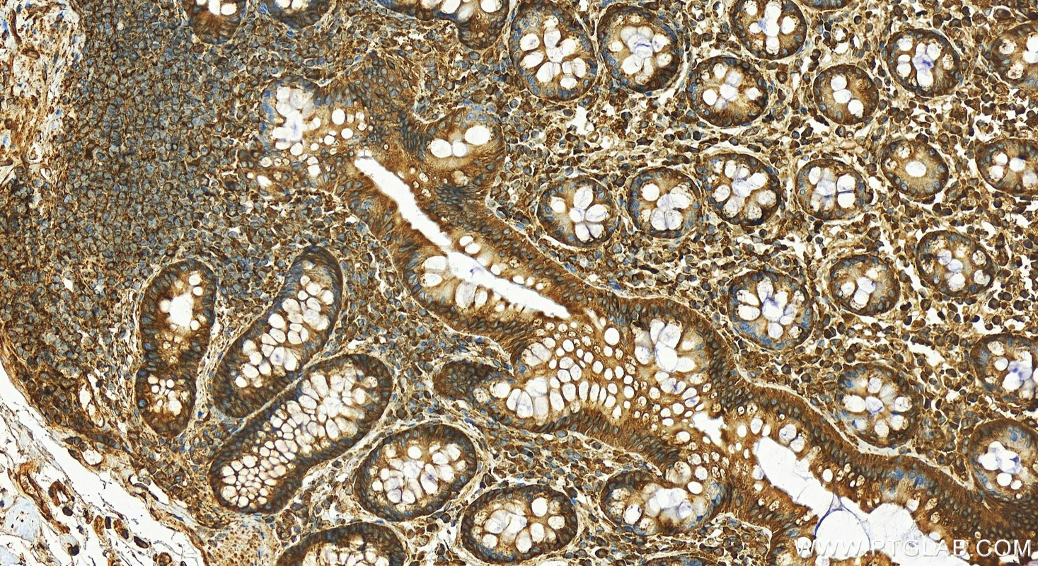 Immunohistochemistry (IHC) staining of human normal colon using ERp57/ERp60 Polyclonal antibody (15967-1-AP)