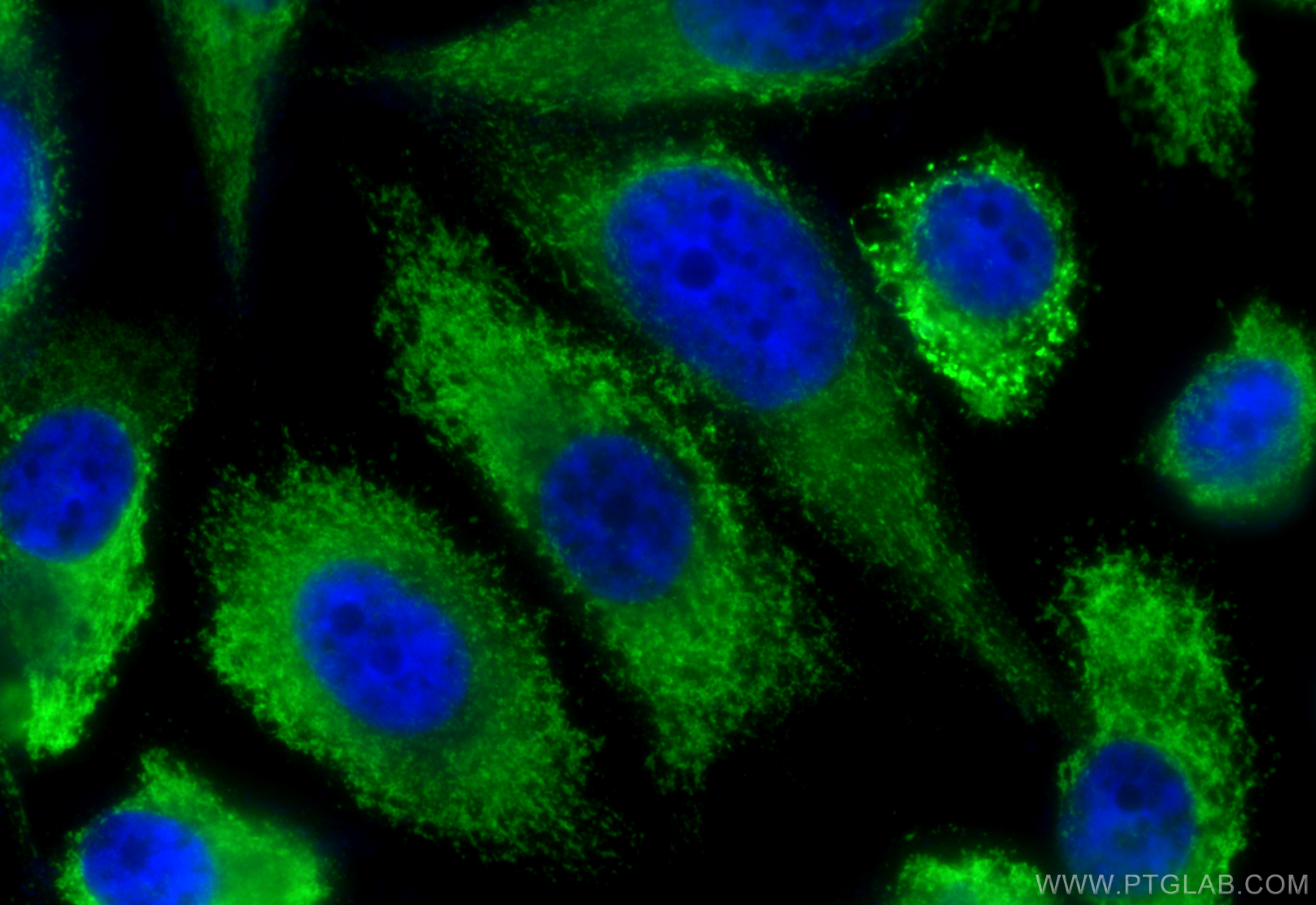 Immunofluorescence (IF) / fluorescent staining of PC-3 cells using ERp72 Polyclonal antibody (14712-1-AP)