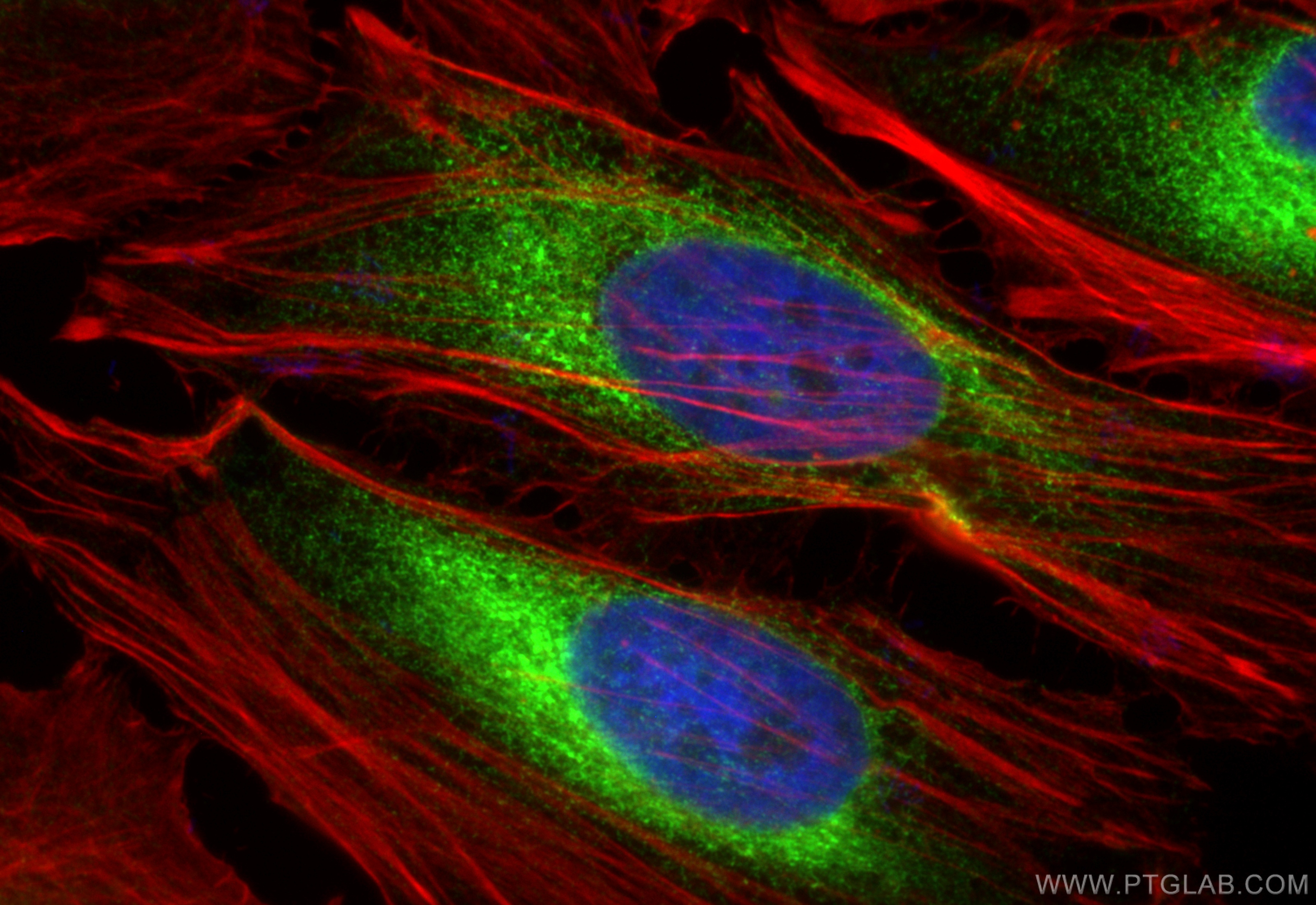 Immunofluorescence (IF) / fluorescent staining of HeLa cells using PDIA6 Polyclonal antibody (18233-1-AP)