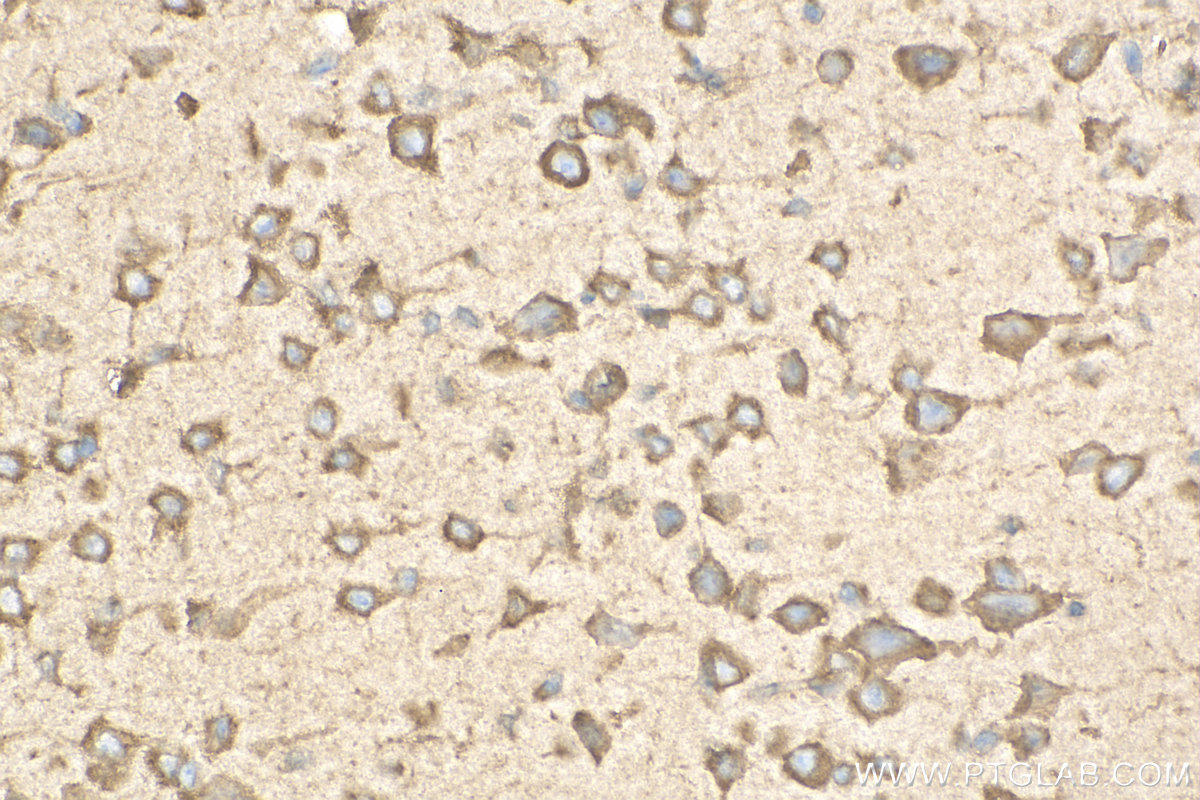 Immunohistochemistry (IHC) staining of mouse brain tissue using PDIA6 Polyclonal antibody (18233-1-AP)