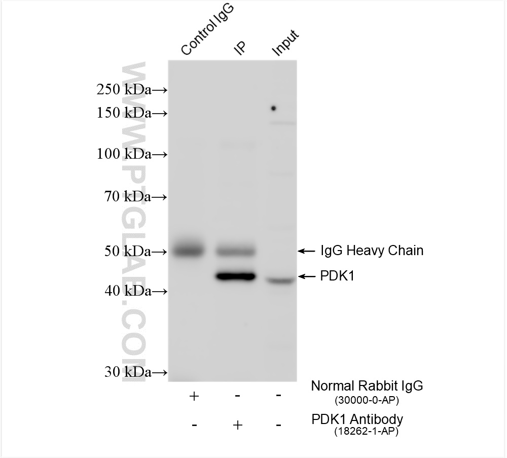 Immunoprecipitation (IP) experiment of SiHa cells using PDK1 Polyclonal antibody (18262-1-AP)
