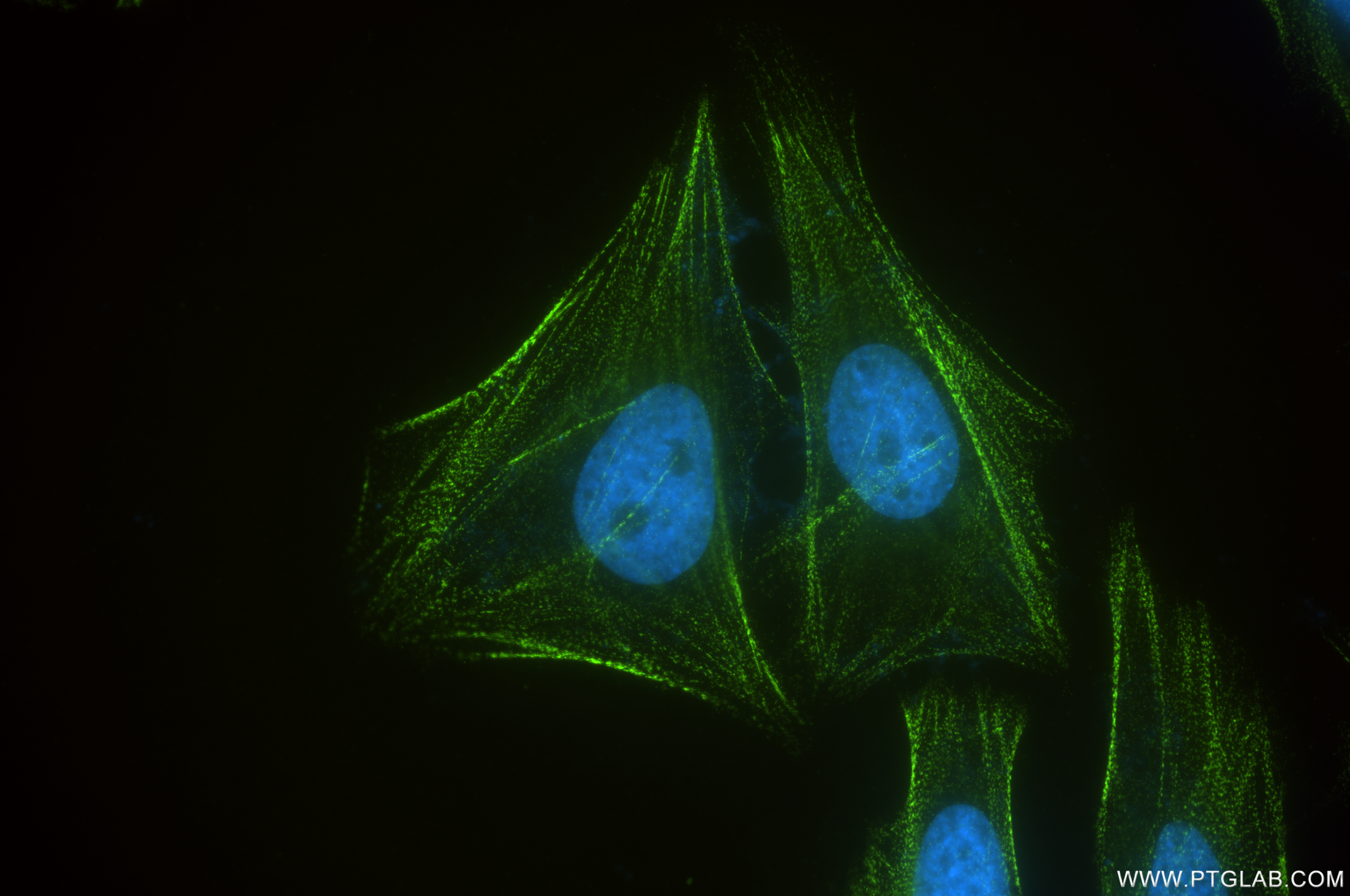 Immunofluorescence (IF) / fluorescent staining of HeLa cells using PDLIM1/CLP36 Recombinant antibody (85027-5-RR)
