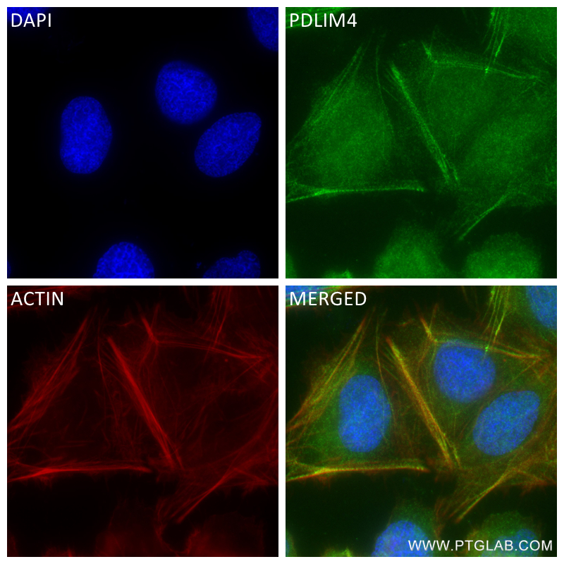 Immunofluorescence (IF) / fluorescent staining of U2OS cells using PDLIM4 Recombinant antibody (84117-1-RR)